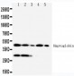 Anti-Haptoglobin Antibody