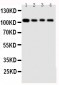 Anti-Hsp105 Antibody