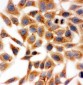Anti-HSD17B1 Antibody