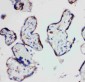 Anti-HSD17B1 Antibody