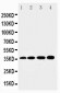 Anti-HSD17B1 Antibody