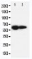 Anti-IL2RB Antibody