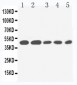 Anti-IL2 Receptor Gamma Antibody