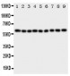 Anti-IL5RA Antibody