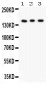 Anti-Insulin Receptor Antibody