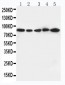 Anti-CD18 Antibody