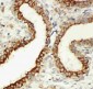 Anti-Integrin Beta 3 Antibody