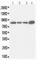 Anti-Integrin Beta 3 Antibody