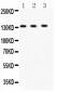 Anti-JAK1 Antibody