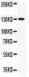 Anti-JAK2 Antibody