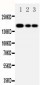 Anti-MRP1 Antibody