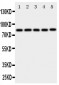 Anti-Ku80 Antibody