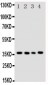 Anti-Bub3 Antibody