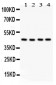 Anti-Cystathionase Antibody