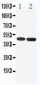 Anti-5HT1A Receptor Antibody