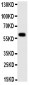 Anti-MAOA Antibody