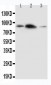 Anti-APLP2 Antibody