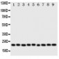 Anti-Cytoglobin Antibody