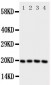 Anti-LCN1 Antibody