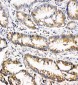 Anti-OSM/Oncostatin M Antibody