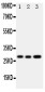 Anti-OSM/Oncostatin M Antibody