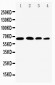 Anti-NF-kB p65 Antibody