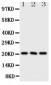 Anti-FGF21 Antibody