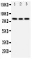 Anti-PIK3R2 Antibody