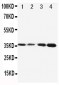 Anti-Protein C Antibody