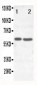 Anti-SLC22A6 Antibody