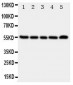 Anti-TACR1 Antibody