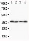 Anti-Stra8 Antibody