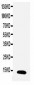 Anti-TFF1 Antibody