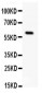 Anti-Somatostatin Receptor 1 Antibody