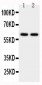 Anti-CYP11A1 Antibody