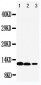 Anti-IL-13 Antibody