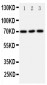 Anti-SLC6A4 Antibody