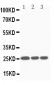 Anti-SOCS3 Antibody