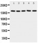 Anti-RFC1 Antibody