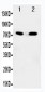 Anti-SDHA Antibody