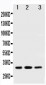 Anti-SDHB Antibody