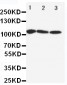 Anti-SERCA1 ATPase Antibody