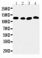 Anti-SERCA2 ATPase Antibody