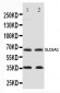 Anti-GABA Transporter 1/GAT 1 Antibody