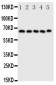 Anti-COX2/Cyclooxygenase 2 Antibody