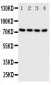 Anti-PAK6 Antibody
