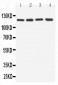 Anti-TLR7 Antibody