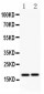 Anti-Caspase-8 (p18) Antibody