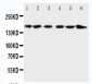 Anti-ALK Antibody