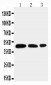 Anti-Aquaporin 2 Antibody